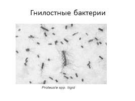 Бактерии, слайд 33