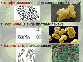 Бактерии: строение и жизнедеятельность, слайд 30