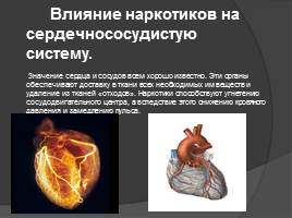 Влияние алкоголя и никотина на сердечно-сосудистую систему, слайд 14