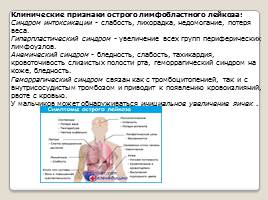 Лимфобластный лейкоз, слайд 3