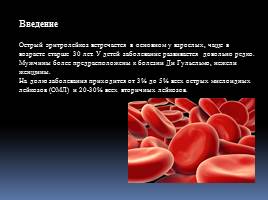Эритромиелоз, слайд 2